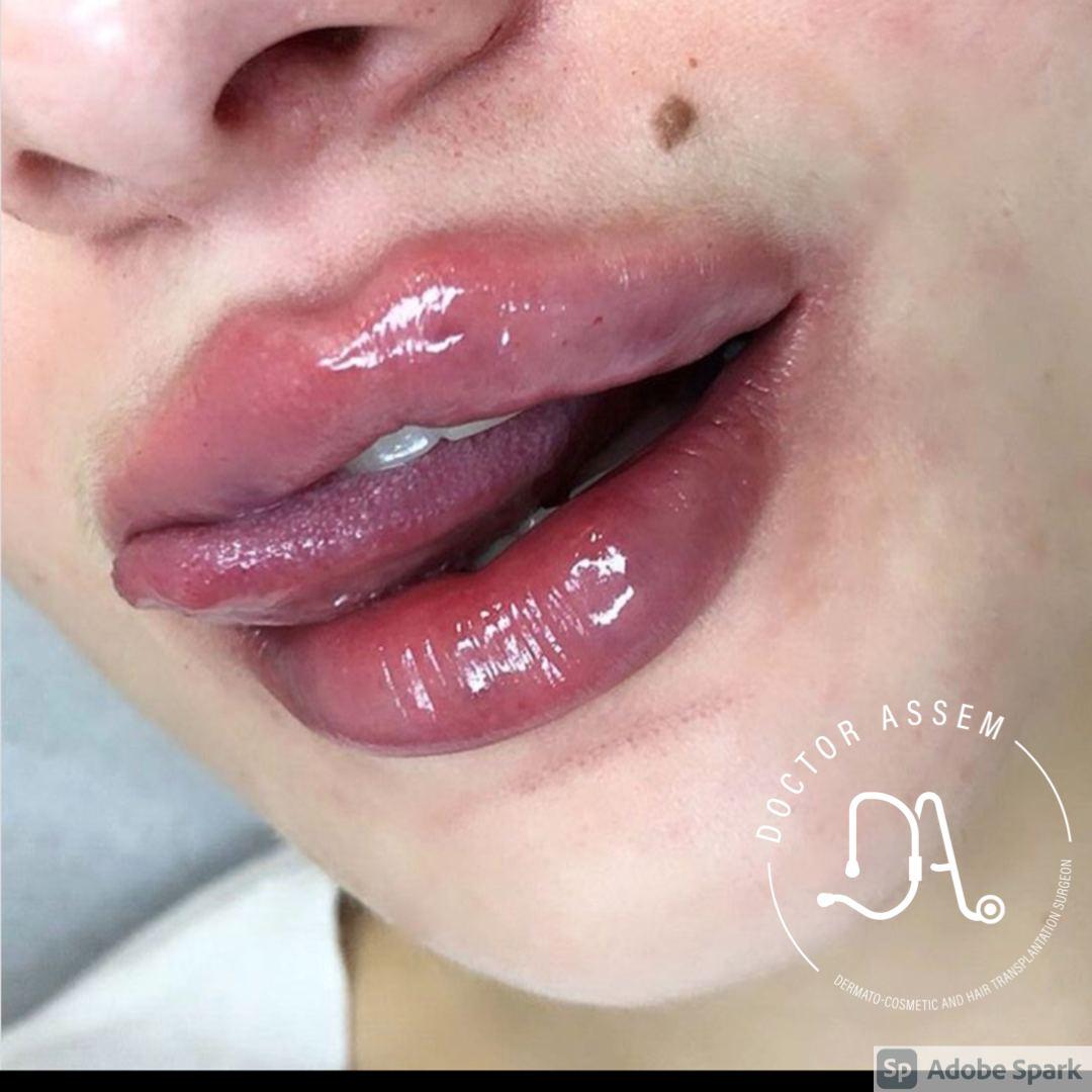 img30